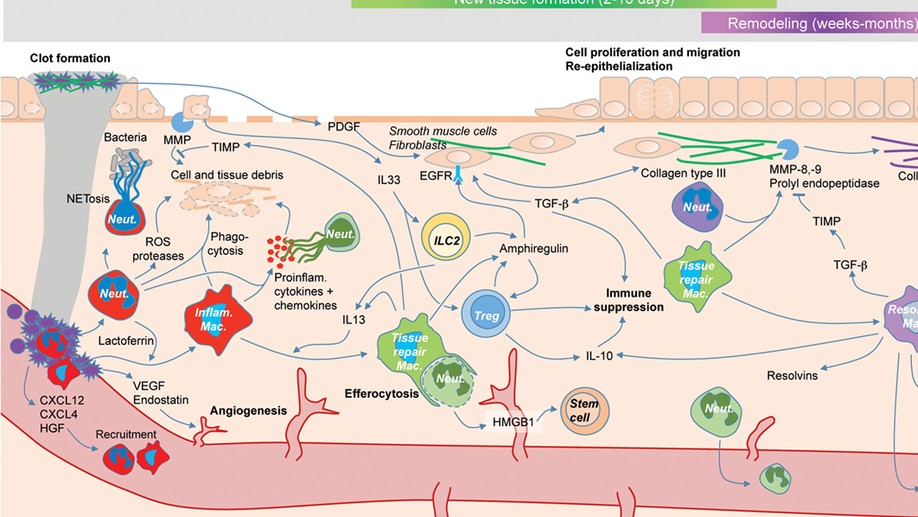 Immune-mediated repair: a matter of plasticity